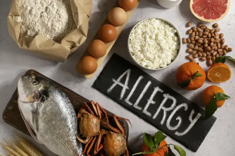 allergens commonly found food